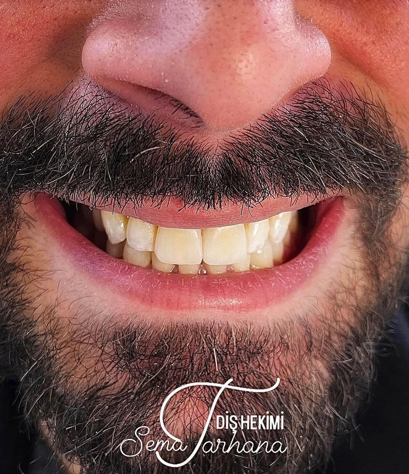 Sema Tarhana Silgu Muayenehanesi